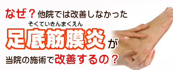 足底筋膜炎・足裏の痛み